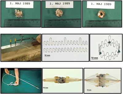 How Transcatheter Aortic Valve Implantation (TAVI) Was Born: The Struggle for a New Invention